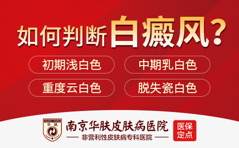 南京白点癫风医院哪家好啊