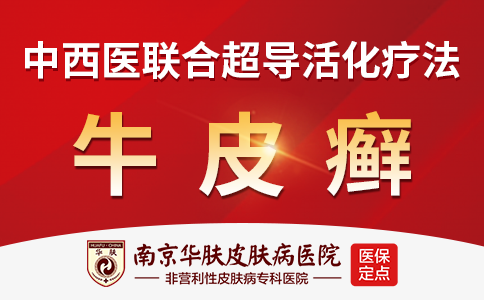 南京治疗牛皮癣比较好的医院是哪个