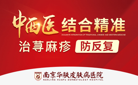 南京治疗荨麻疹医院位置在哪