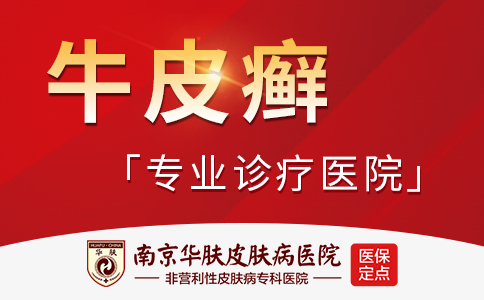 南京银屑病检查治疗医院排名