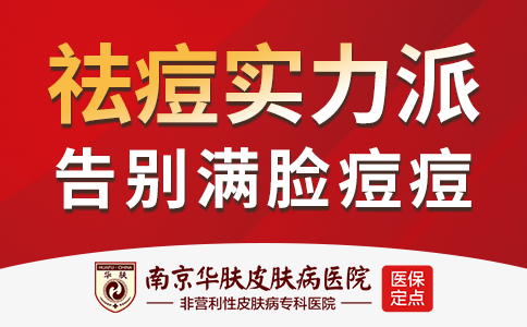 南京去除青春痘哪里专业