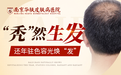 南京有治疗脱发的医院吗